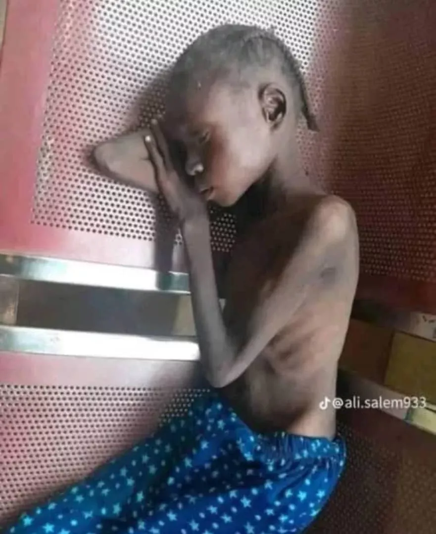 The child of the child ... Hunger is based on the shoulder of the world ✍️ Awad Allah Nawi