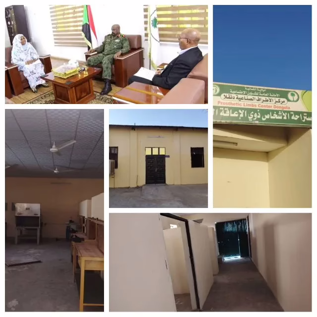 The fire destroys the prostheses and society factory. He builds: reflects the spirit of solidarity, cooperation and a society